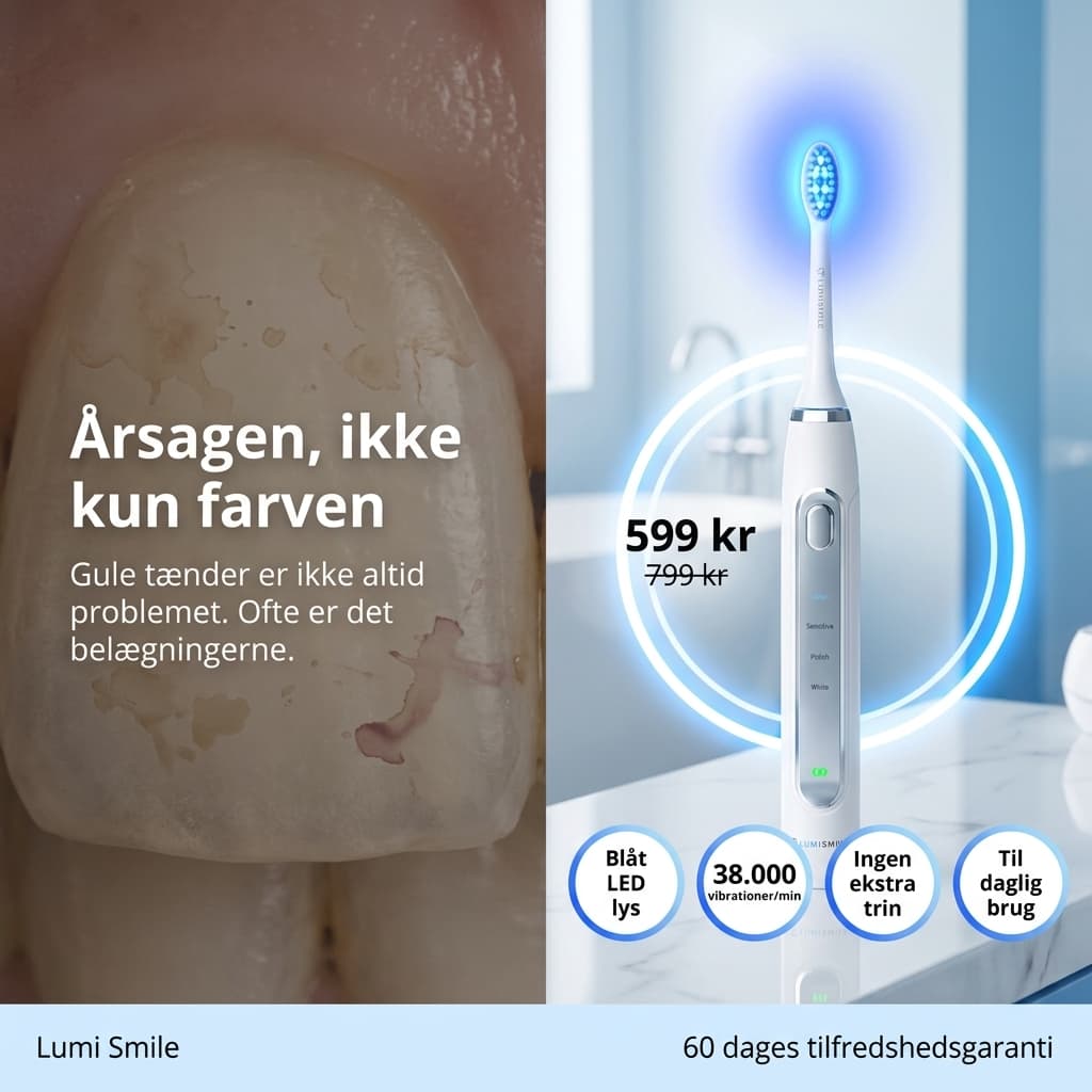 Lumi Smile: Årsagen, ikke kun farven — pris og USPs